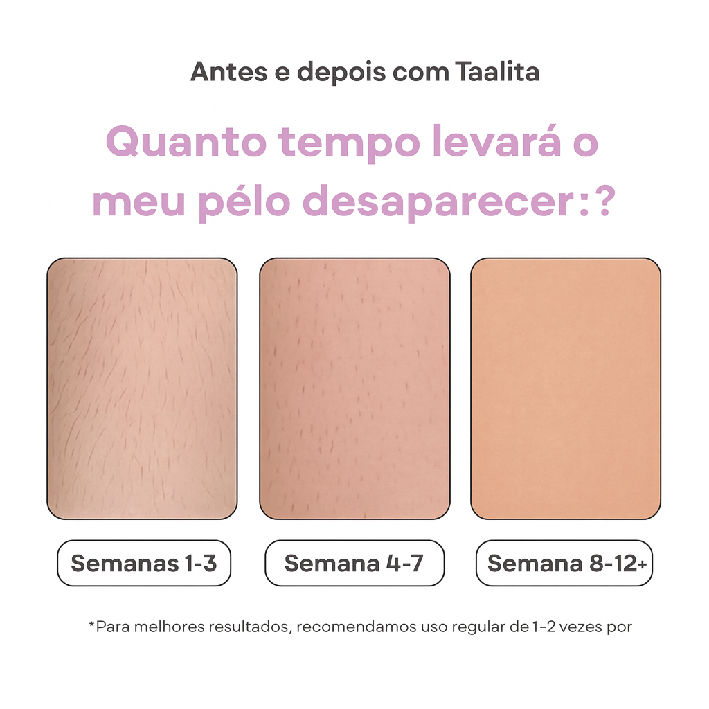Depilador IPL Taalitas I O depilador a laser líder para uso doméstico