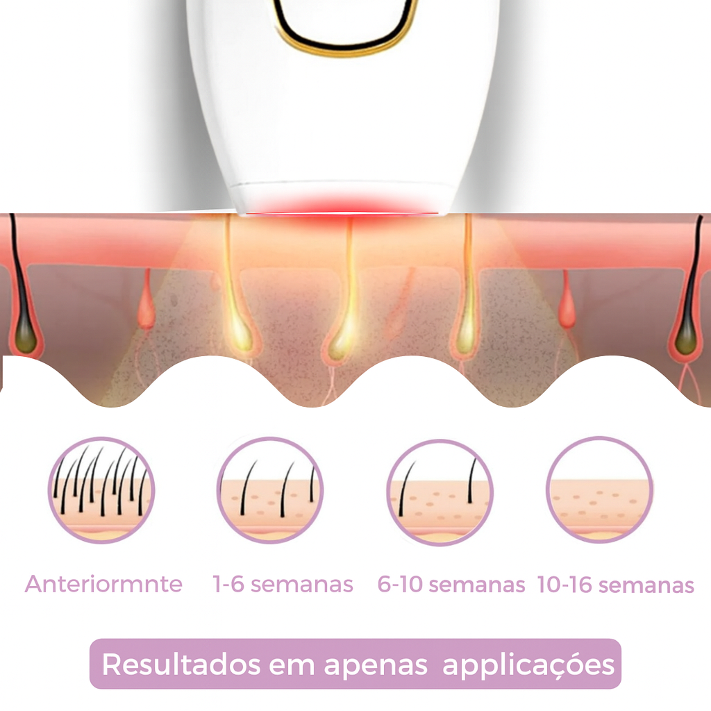 Depilador IPL Taalitas I O depilador a laser líder para uso doméstico
