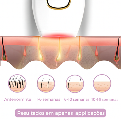 Depilador IPL Taalitas I O depilador a laser líder para uso doméstico
