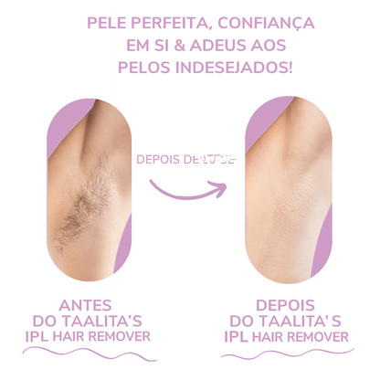 Depilador IPL Taalitas I O depilador a laser líder para uso doméstico